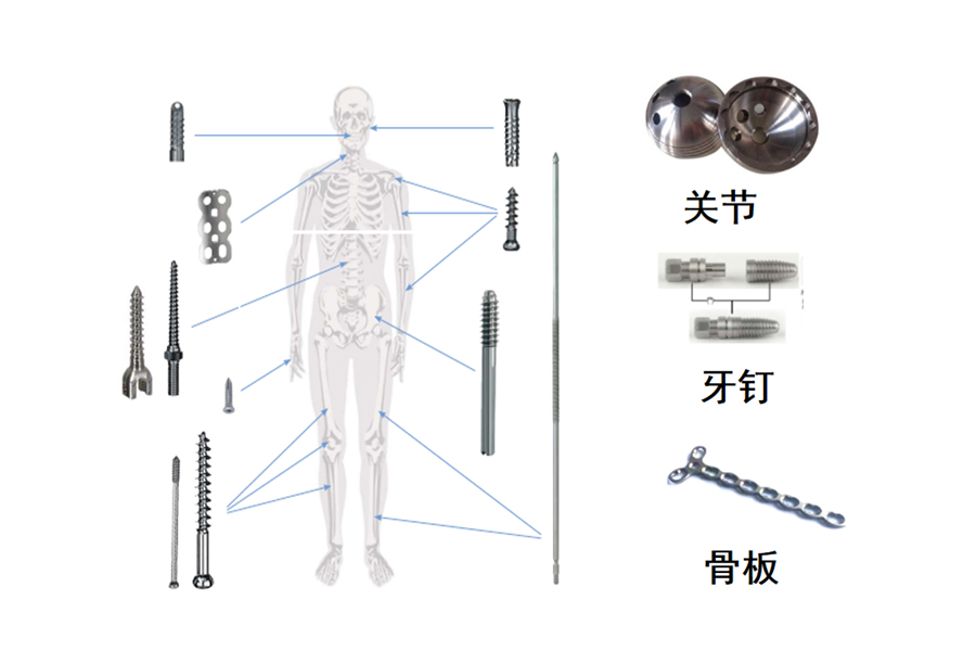 醫(yī)療骨科、牙釘、脊椎